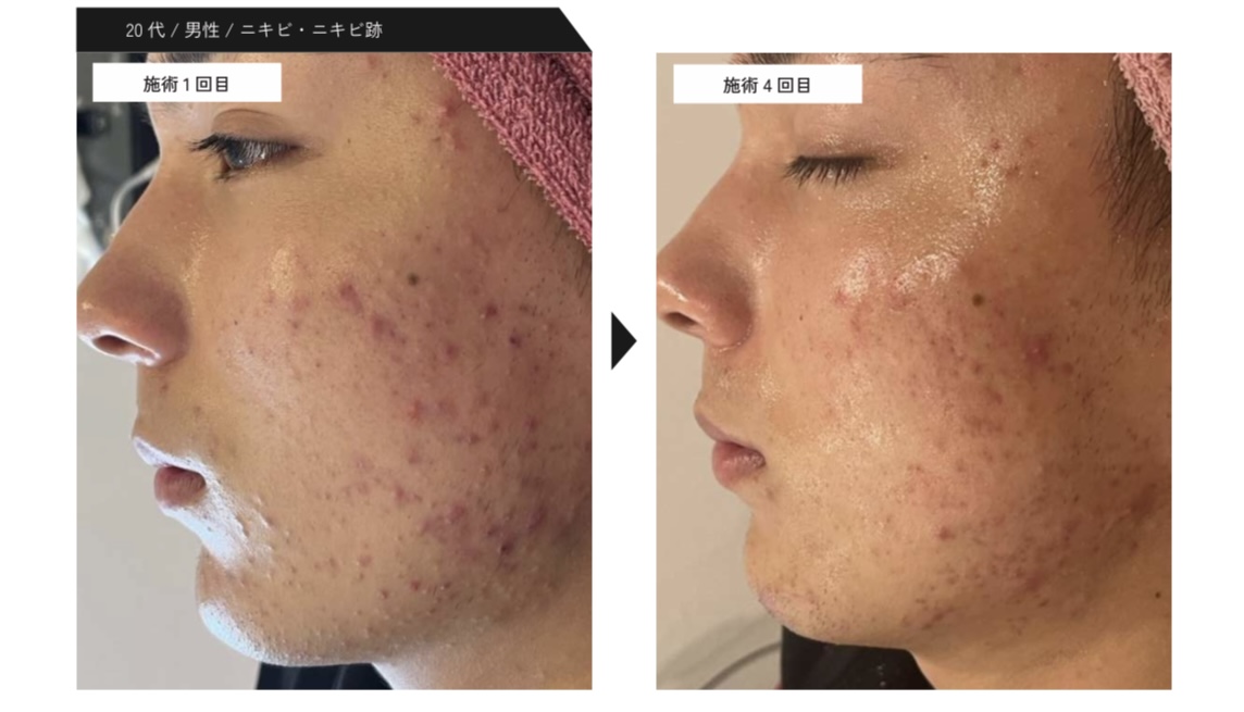 20代男性