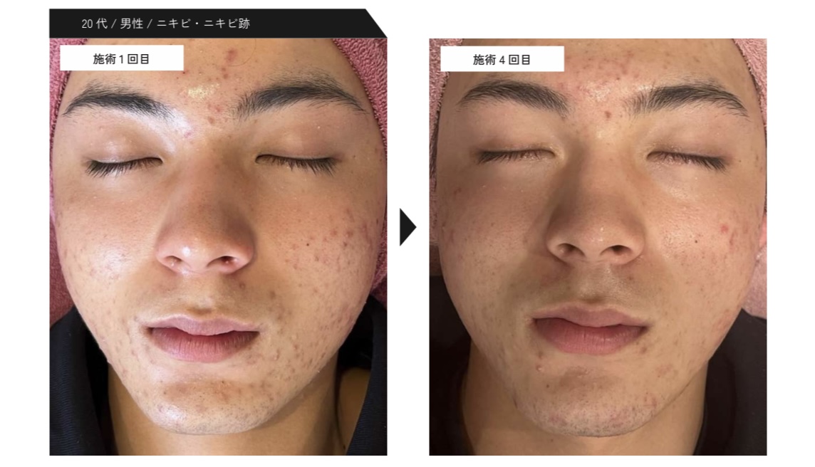 20代男性