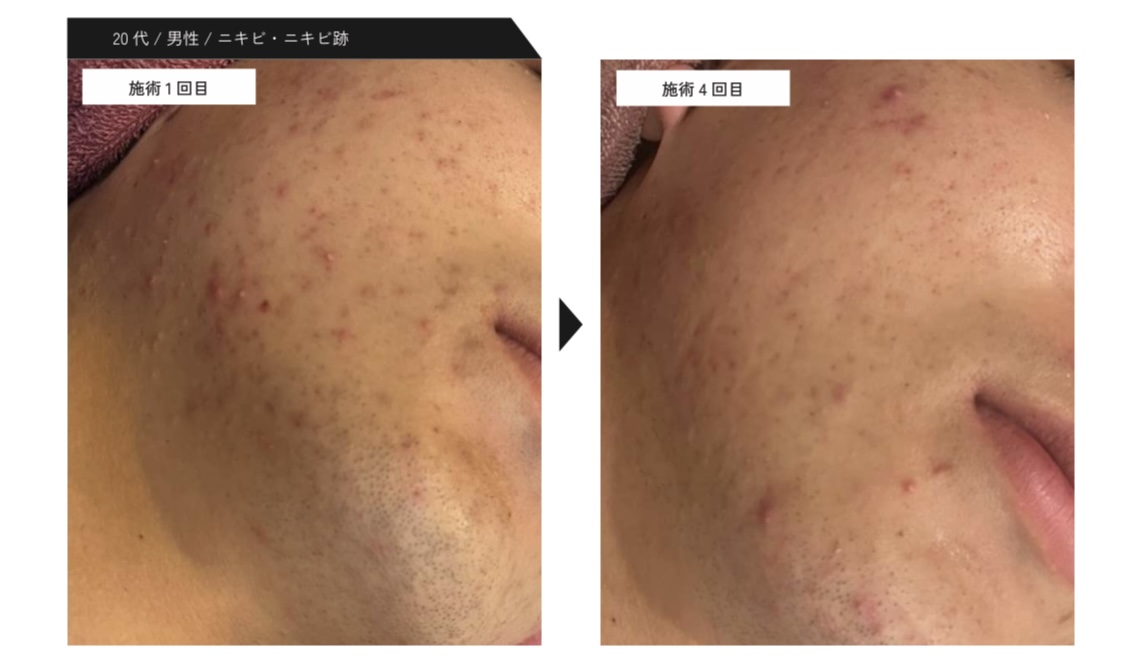 20代男性