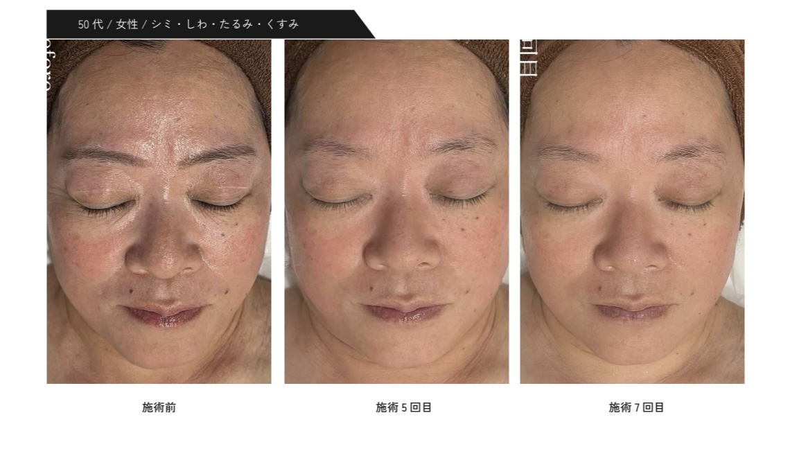 50代女性