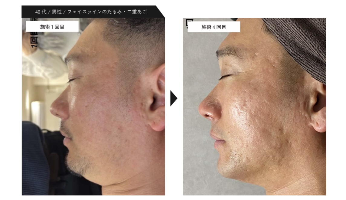 40代男性